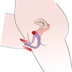 You2Toys Intimate Spreader - Flexibel & Hautfreundlich You2Toys Intimate Spreader - Flexibel & Hautfreundlich – C