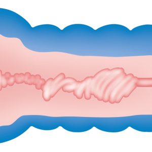 Nature Skin Soft Vagina - Masturbator für leichte Reinigung und griffige Handarbeit Blau/Hautfarben hell